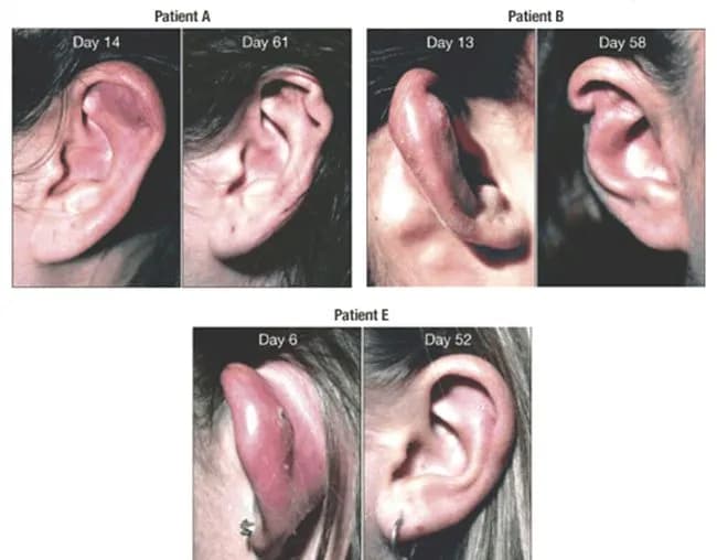 Gdzie zrobić kolczyki? Przewodnik po piercingu: uszy, nos, ciało