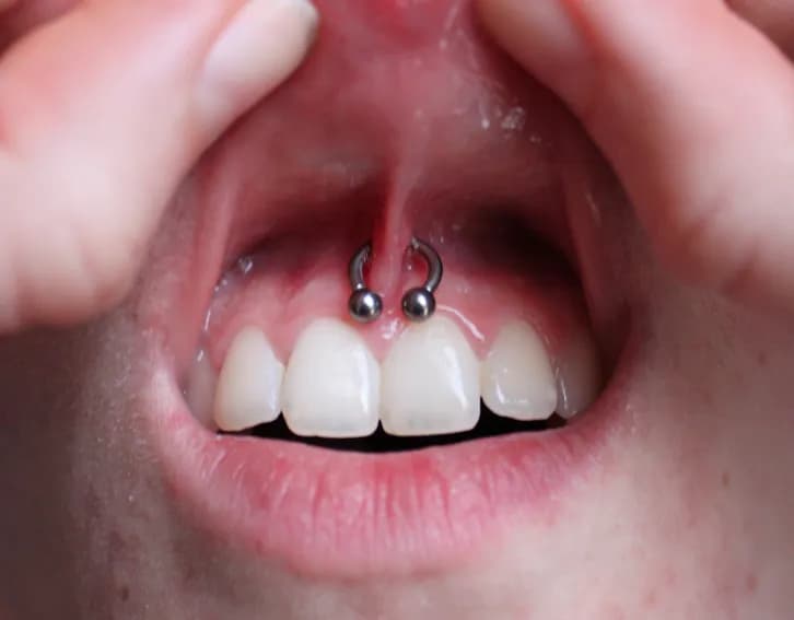 Jaki rozmiar kolczyka do smiley? Bezpieczny wybór i ryzyka